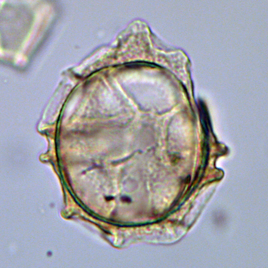 Phthanoperidinium sp., 1408C-16H-5W, 21-22, sl. 1, N23, foto-b.jpg